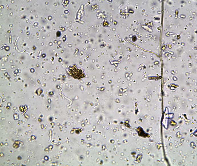 Fungal hyphae rod shaped bacteria and other bacteria seen under a microscope.