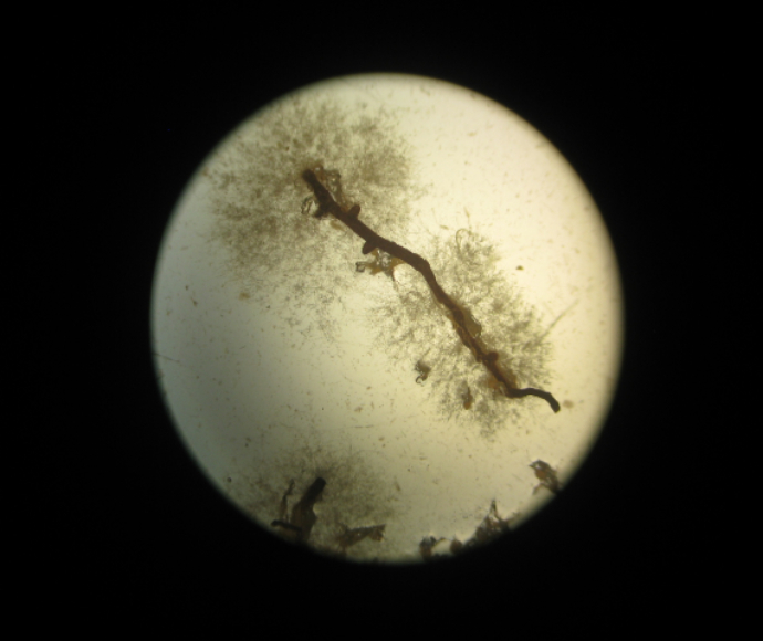 View of the Phytophthora cinnamomi infection under a microscope